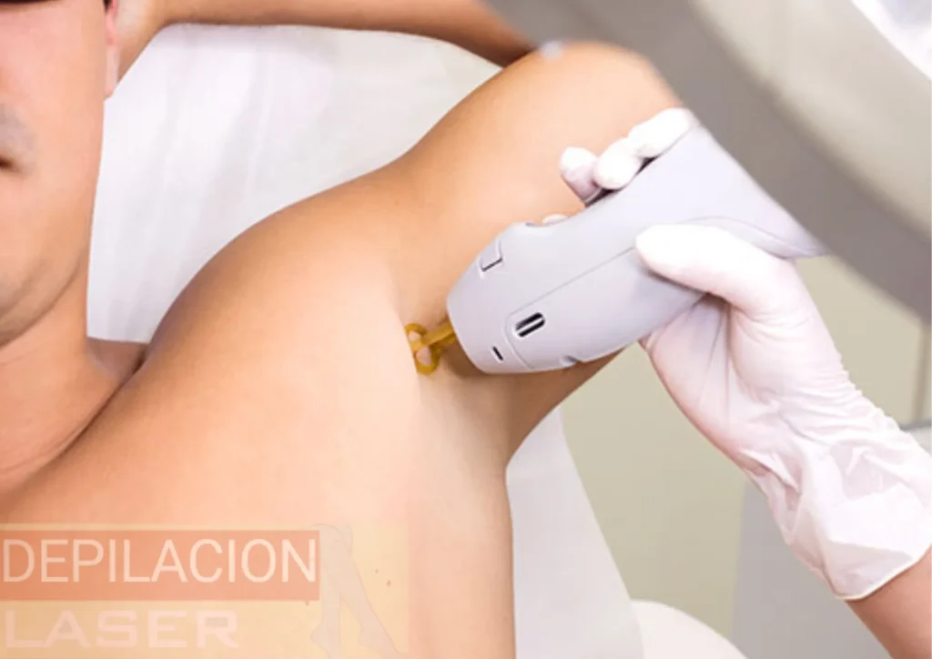 Depilacion Laser Near Me Gijon